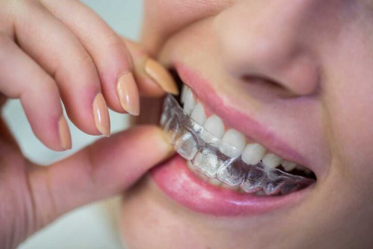 алайнери